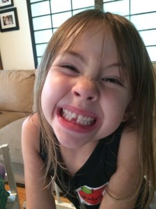 My daughter, proudly showing off where her tooth had been...Quite an ending to her first day of Kindergarten.