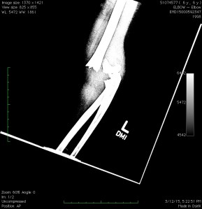 One for the family photo album